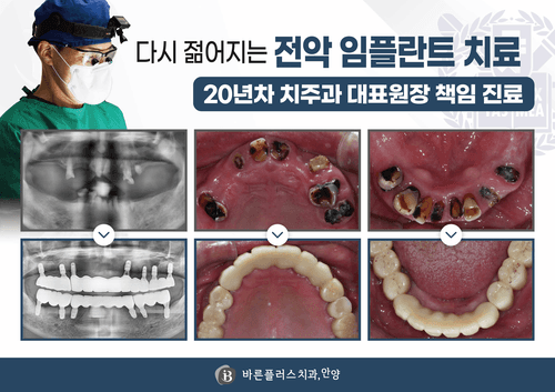 안양바른플러스치과의원 3번째 이미지