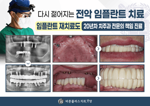 안양바른플러스치과의원 4번째 이미지