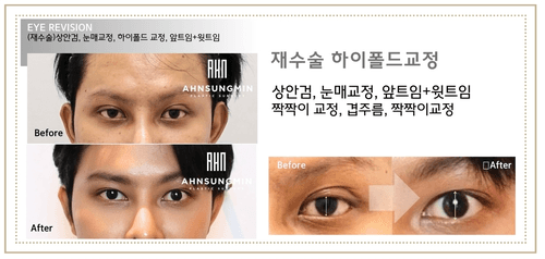 안성민성형외과의원 9번째 이미지