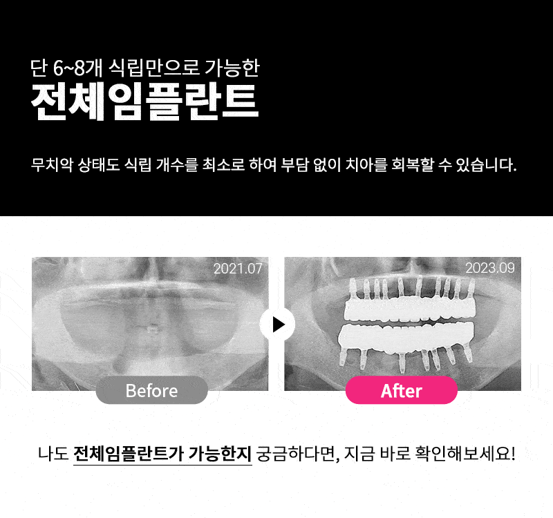 이벤트 이미지 - 3