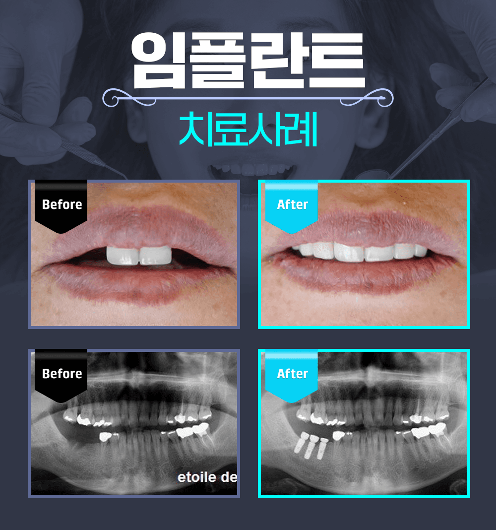 이벤트 이미지 - 1