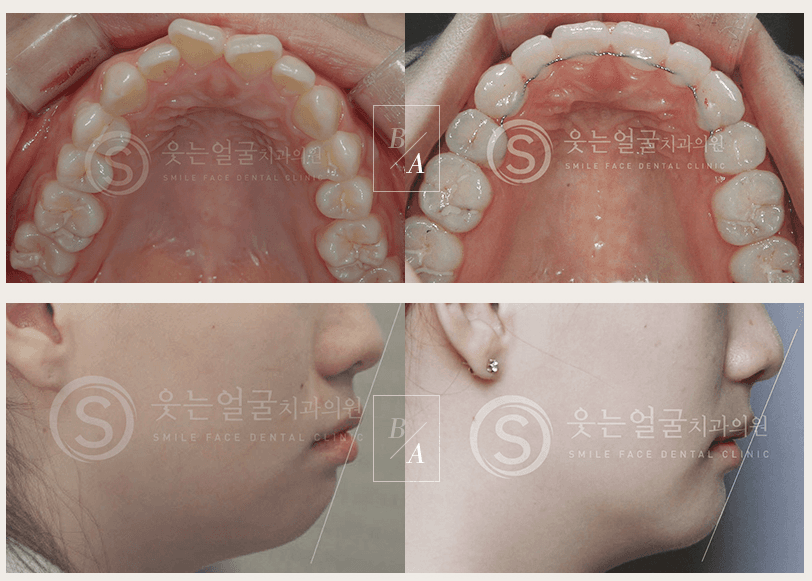 이벤트 이미지 - 3
