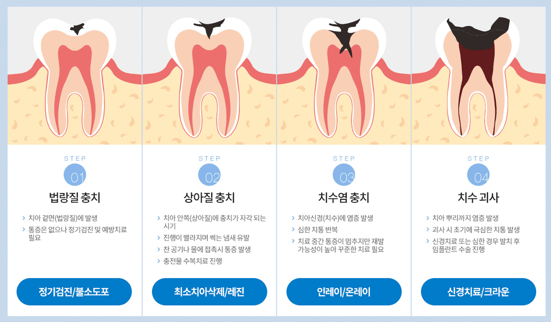 이벤트 이미지 - 2