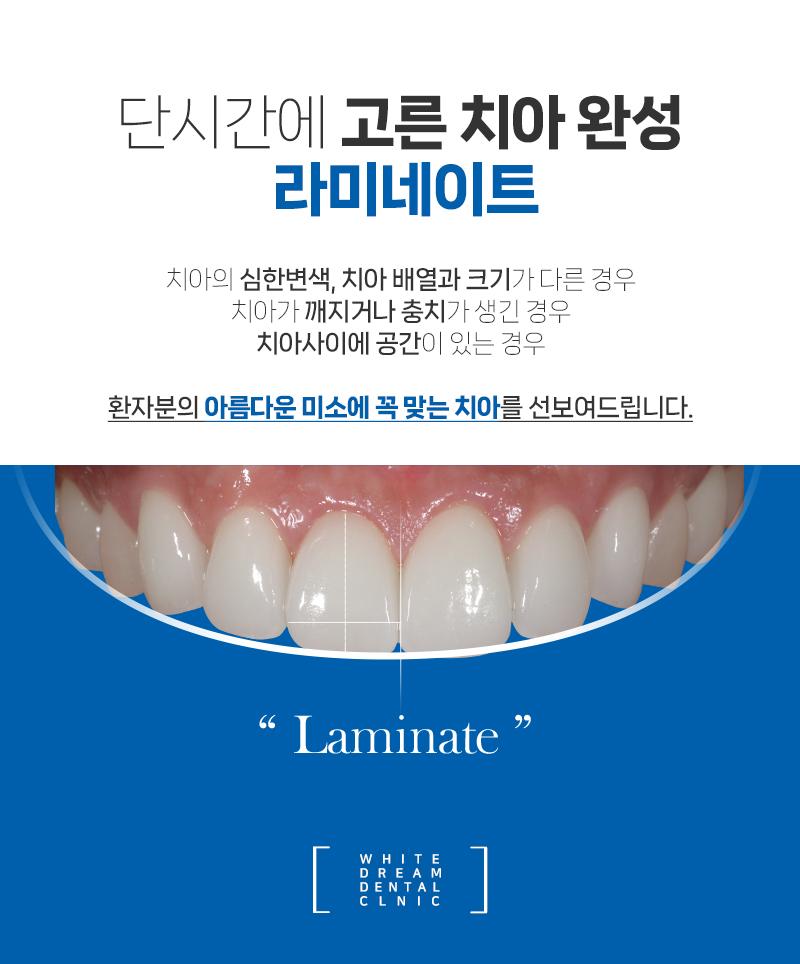 이벤트 이미지 - 2