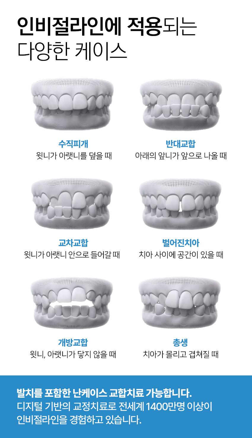 이벤트 이미지 - 6