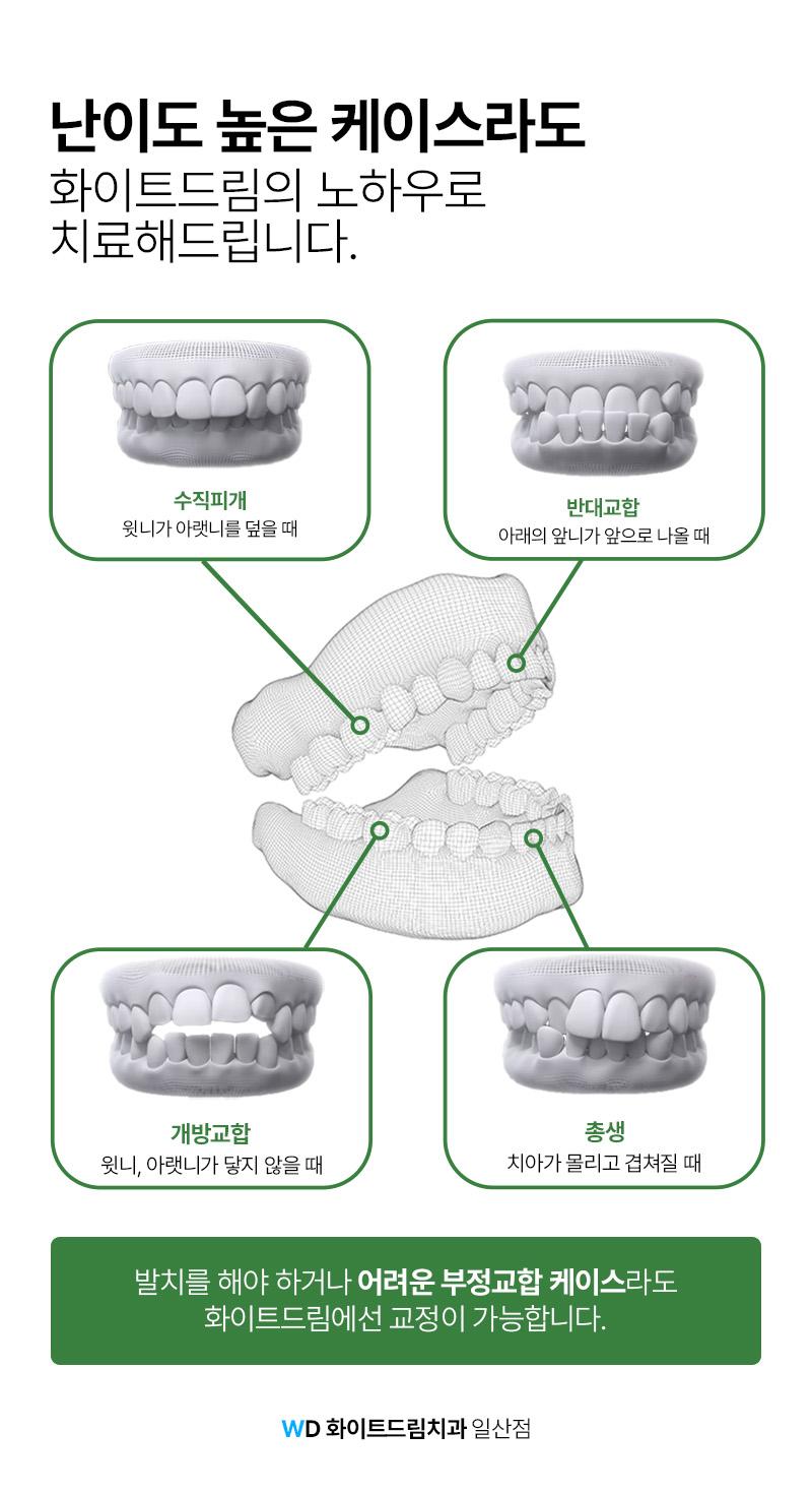 이벤트 이미지 - 4