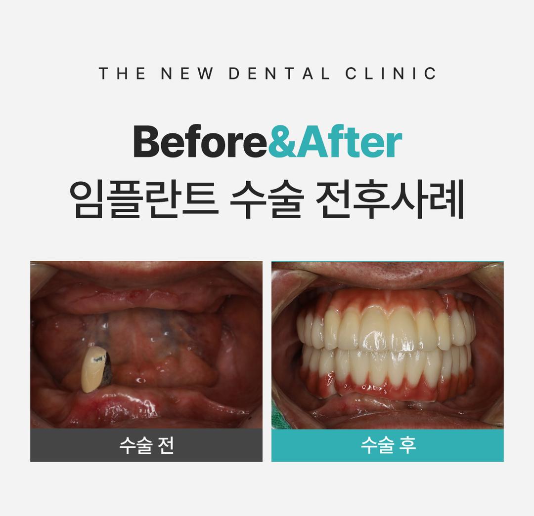 이벤트 이미지 - 5