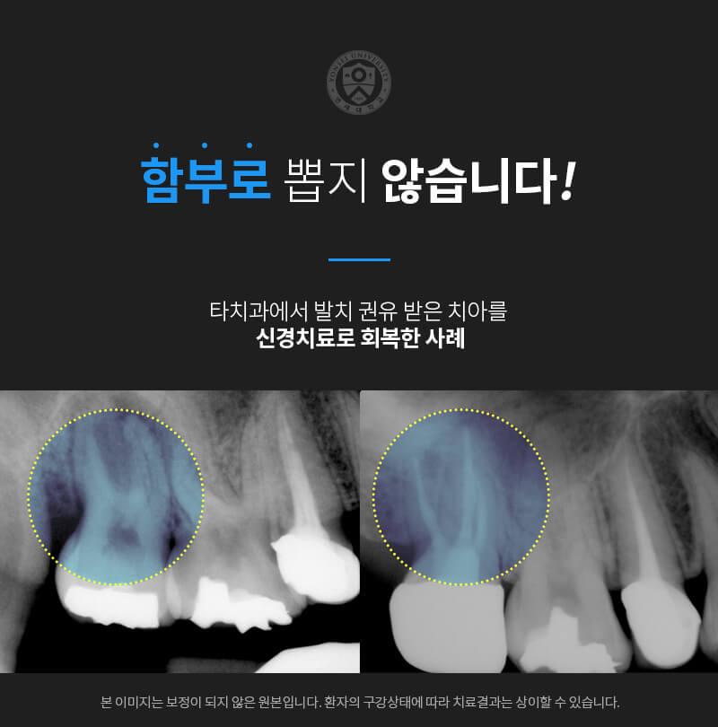 이벤트 이미지 - 13
