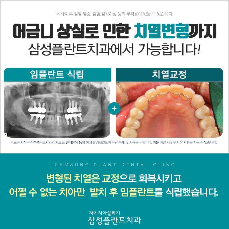 이벤트 이미지 - 1