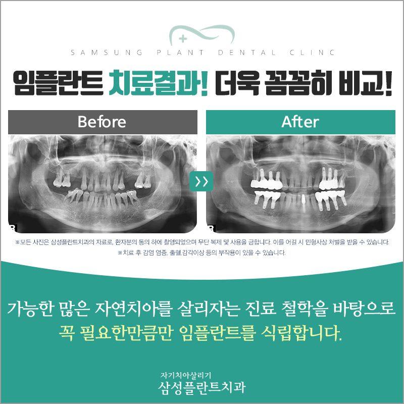 이벤트 이미지 - 3