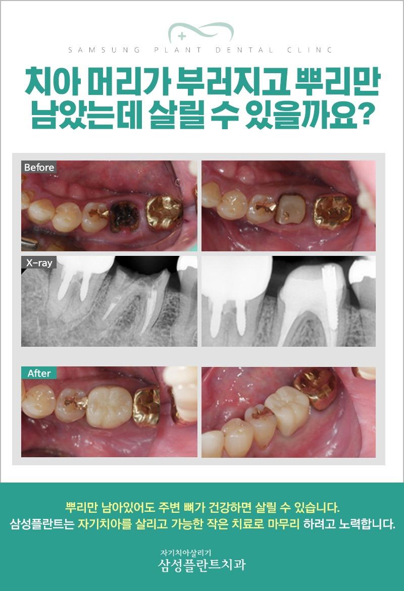 이벤트 이미지 - 0