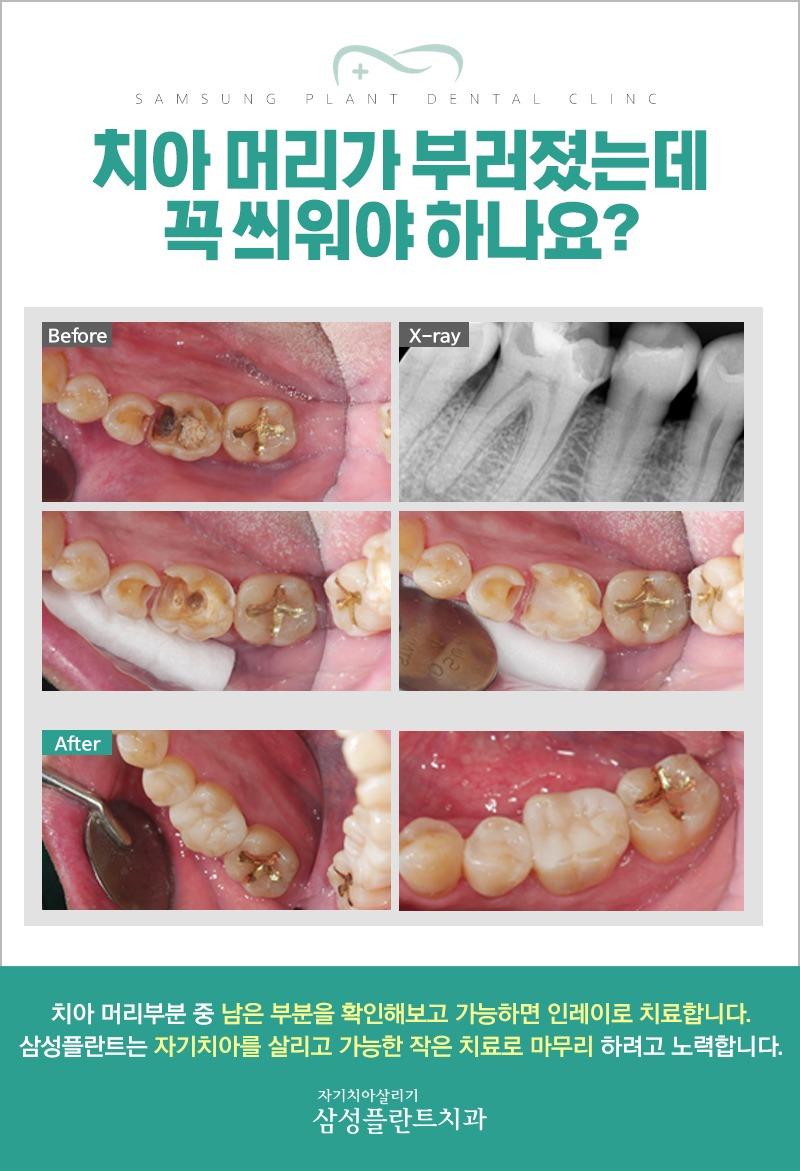 이벤트 이미지 - 2