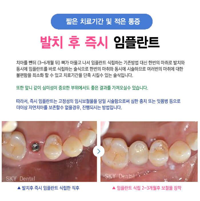 이벤트 이미지 - 5