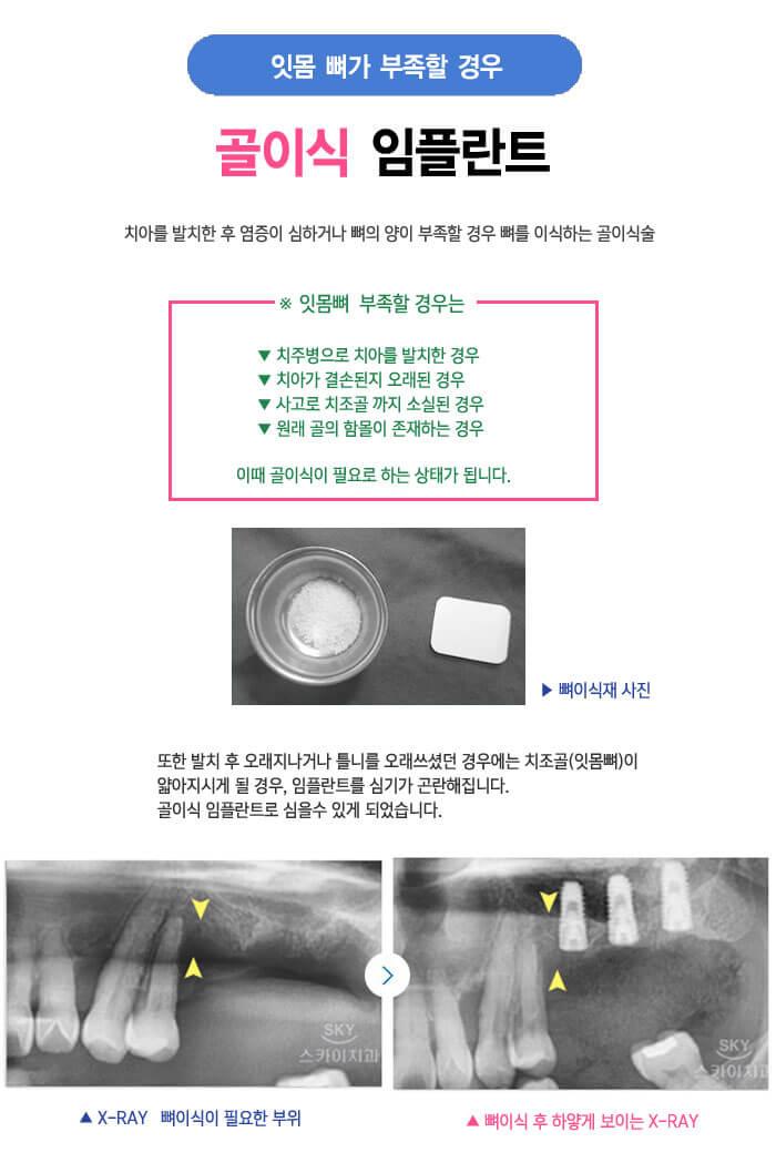 이벤트 이미지 - 6