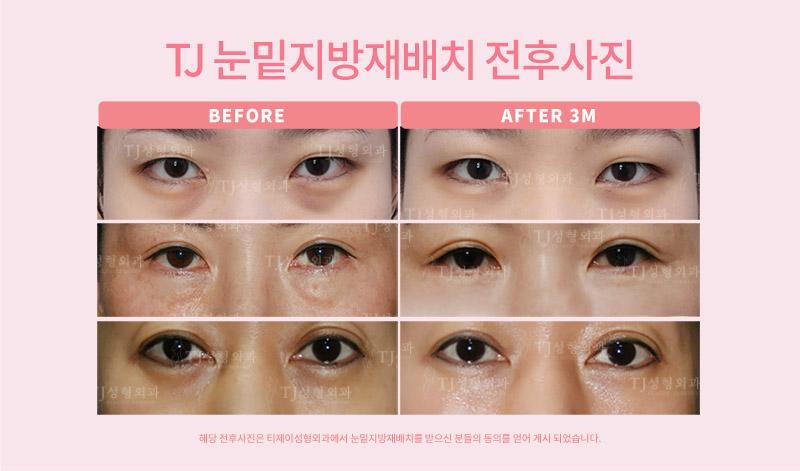 이벤트 이미지 - 0