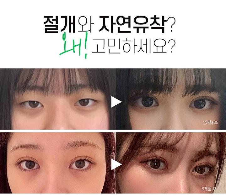 이벤트 이미지 - 1
