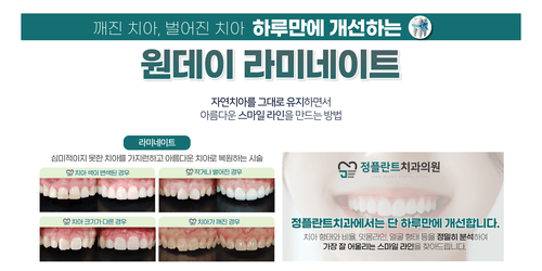 아산정플란트치과의원 10번째 이미지