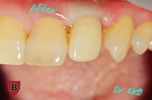 365보스턴치과의원 4번째 이미지