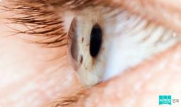 라섹 후 각막혼탁 예방법, 원인에 따라 관리해야 합니다의 썸네일