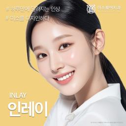 인레이_이미지
