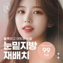 눈밑지방재배치_이미지