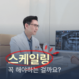 🦷스케일링, 꼭 해야 할까요?의 썸네일