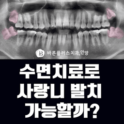 수면치료로 사랑니 발치 가능할까?의 썸네일