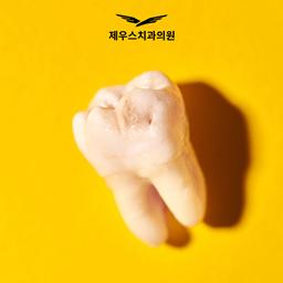 ✨사랑니 발치✨의 썸네일