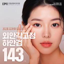 하안검수술_이미지