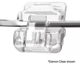 데이몬클리어 교정 vs 클리피씨 교정 vs 인비절라인 투명교정 : 치과 의사가 총정리합니다의 썸네일