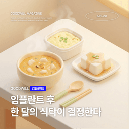 임플란트 후 한 달의 식탁이 결정한다!의 썸네일