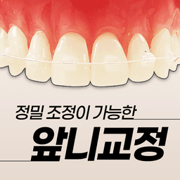 앞니교정_이미지