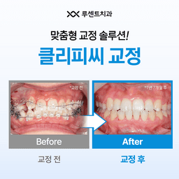 클리피씨교정_이미지