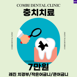 충치치료 검진_이미지