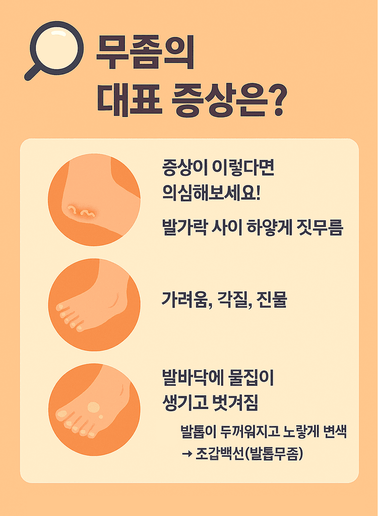🦶 “발 사이 하얗게 갈라지고 가렵다면? 무좀, 방치하면 곤란합니다!” (2026) | 모두닥